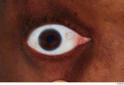 Eye Man Black Eye Textures